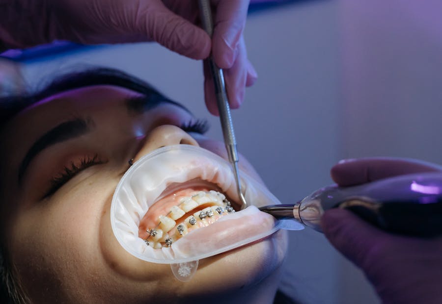 Terapie dentară
